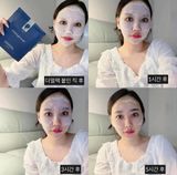  Mặt Nạ Thạch Collagen Nâng Cơ Chống Lão Hóa DERM'ALL MATRIX Facial Derma Mask Hàn Quốc 