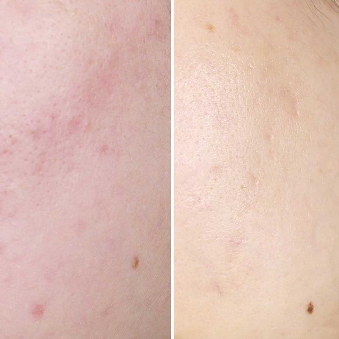 Kem Dưỡng Trắng Da Đêm Senka White Beauty Glow Gel Cream