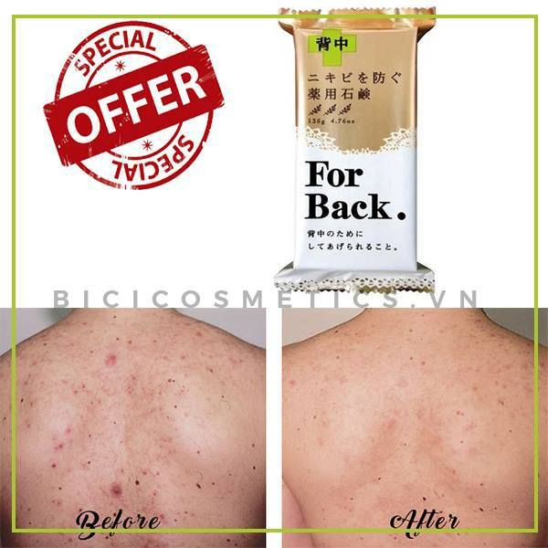 Xà Phòng Trị Mụn Lưng For Back Nhật