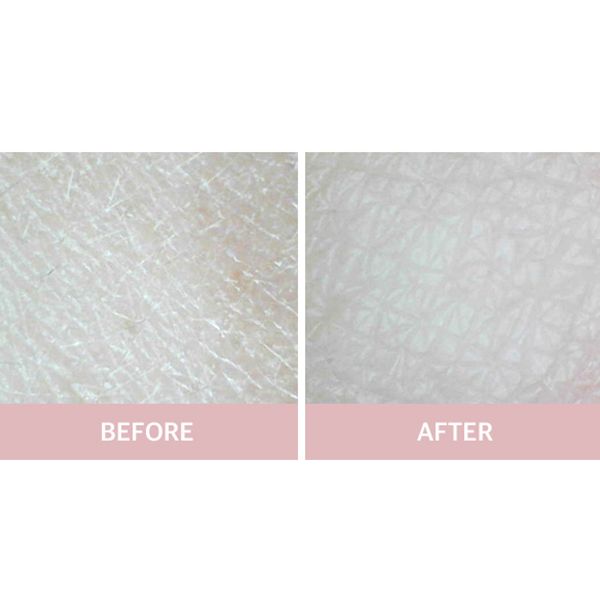 Mặt Nạ Đất Sét A’pieu Calamine Clay Pack