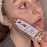  Kem Trị Mụn, Mờ Thâm Acne-Derm Kwas Azelainowy 20% 