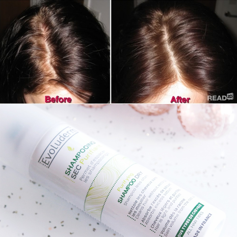 Dầu Gội Khô Sampooing Sec Purifiant Evoluderm