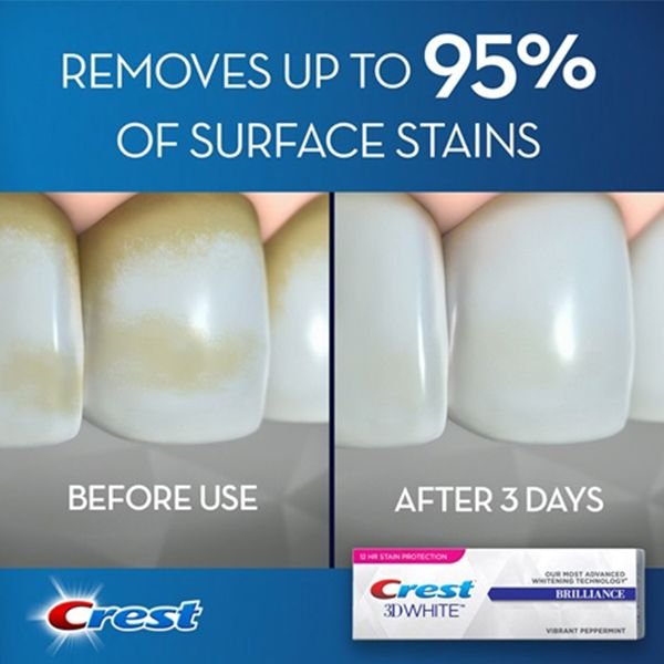 Kem đánh răng Crest 3D White Brilliance + Advanced Stain Protection