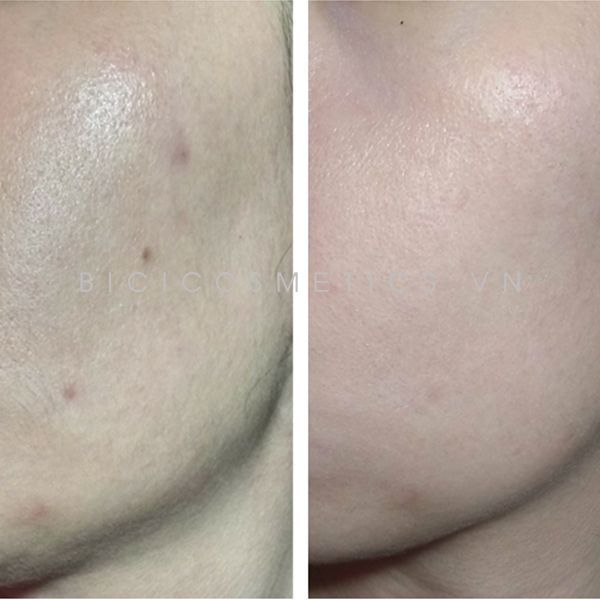 Tinh Chất Trị Thâm Rohto Melano CC Anti Spot Essence