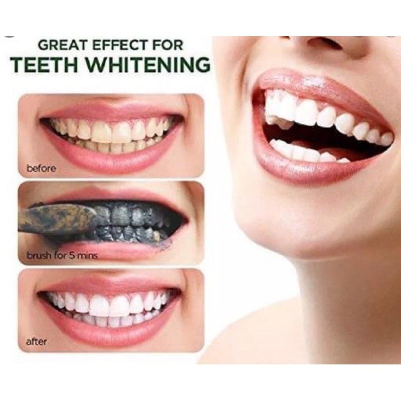  Kem đánh răng Trắng Răng Than Tre Crest 3D White Whitening Therapy Charcoal Deep Clean 116g 