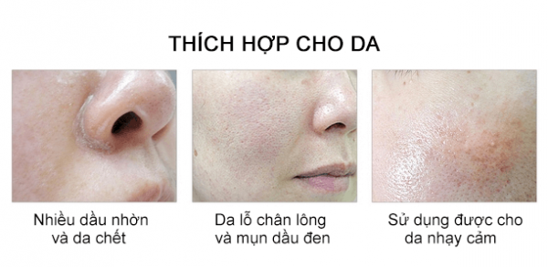 Mặt Nạ So’ Natural Special Care Pink Eraser Calamine Mask