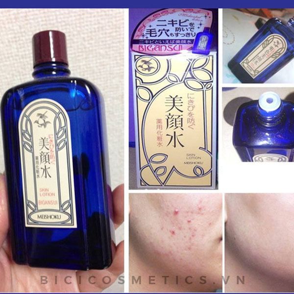 Nước Hoa Hồng Trị Mụn Meishoku Bigansui Medicated Skin Lotion