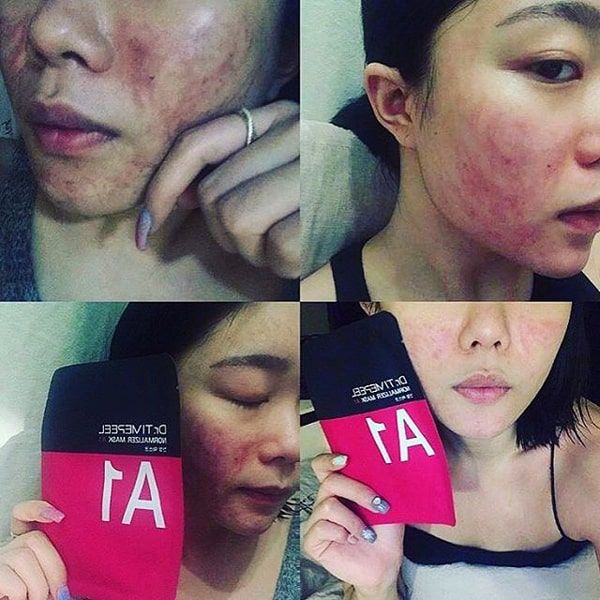 Mặt Nạ Dr Timepeel A1 Normalizer
