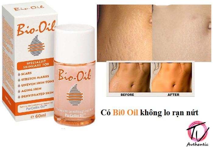  Tinh Dầu Trị Rạn Da, Mờ Sẹo BIO OIL Skincare Oil 