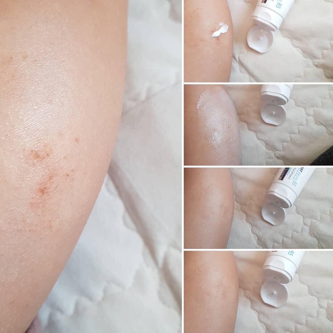 Kem Dưỡng Làm Dịu Và Phục Hồi Da La Roche-Posay Cicaplast Baume B5 (40ml)