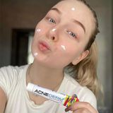  Kem Trị Mụn, Mờ Thâm Acne-Derm Kwas Azelainowy 20% 