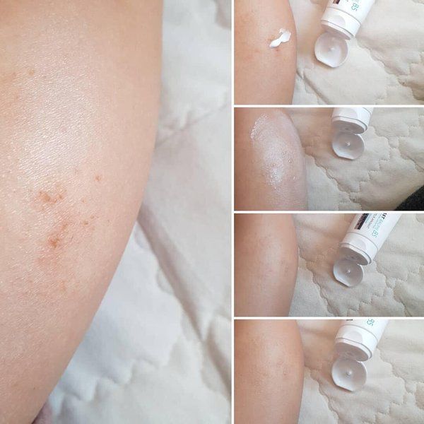 Kem Dưỡng La Roche-Posay Cicaplast Baume B5 Làm Dịu & Phục Hồi Da + Tặng Kèm Qùa (không tích điểm)