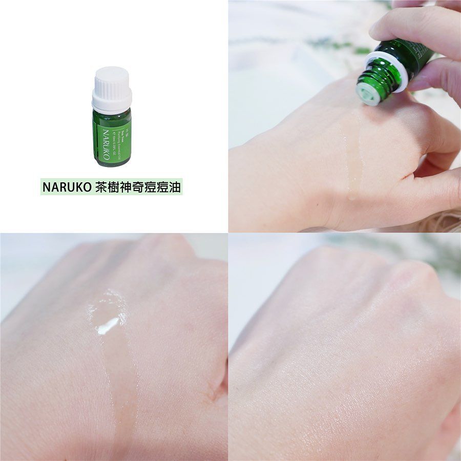 Tinh Dầu Trị Mụn Naruko Tea Tree Purifying Essential Oil 10ml
