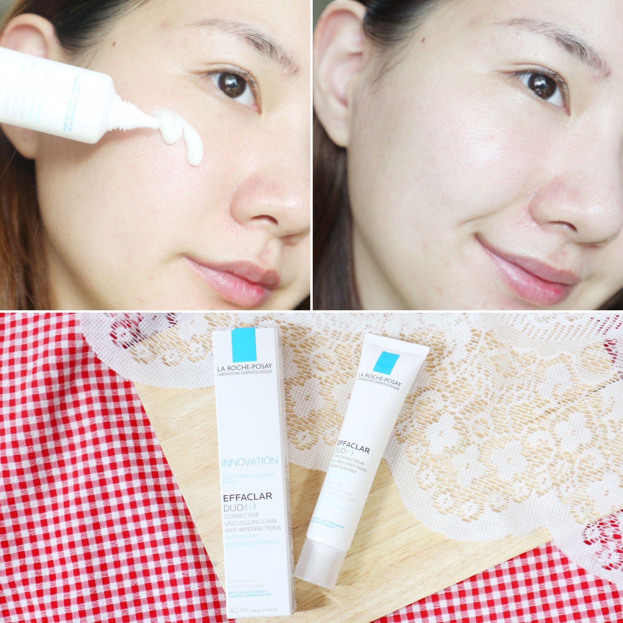 Kem Dưỡng Giảm Mụn, Ngừa Vết Thâm La Roche-Posay Effaclar Duo+ Plus 40ml