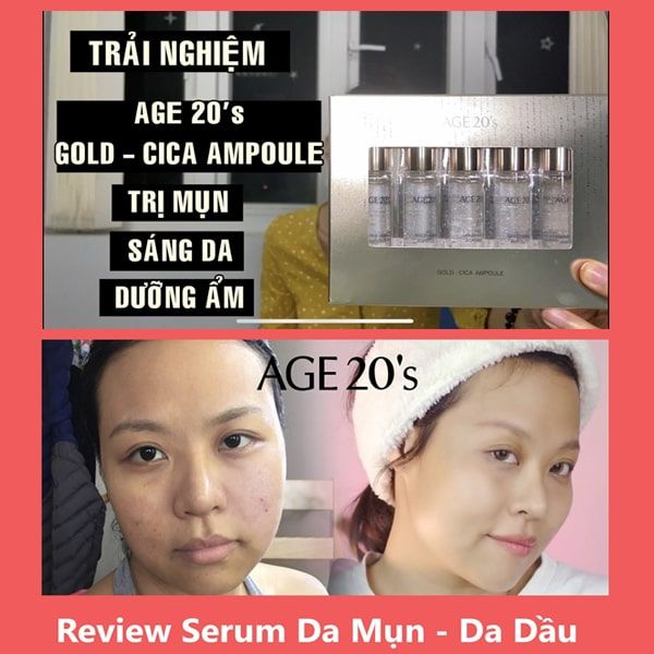 Set Tinh Chất Age 20's Gold - Cica Ampoule