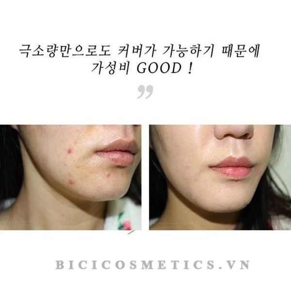 Gel Che Mụn L’arvore Derma Skin Patch (15ml)