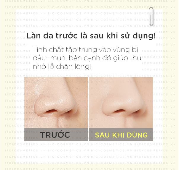Thanh lăn trị mụn vùng chữ T A’PIEU Hamamelis T-zone Serum