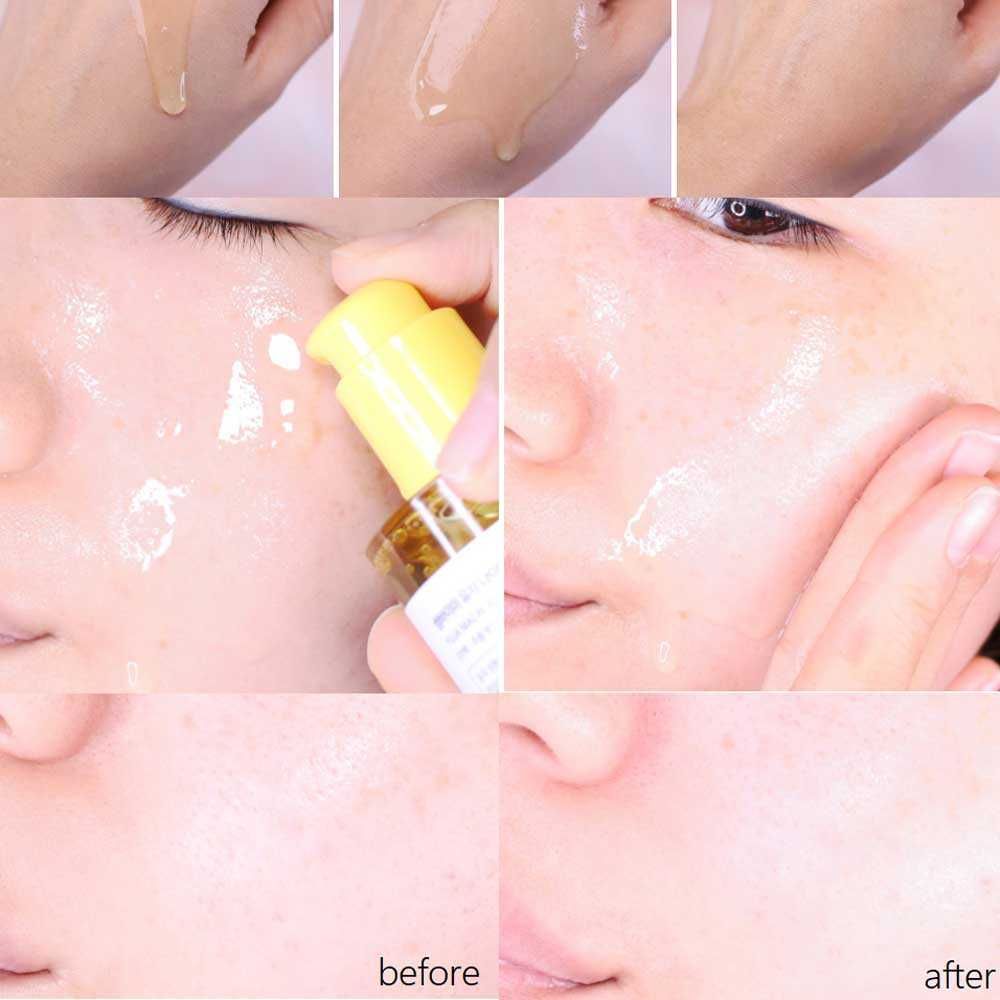Set Dưỡng Trắng Some By Mi Yuja Niacin 30Days Brightening Started Kit 4 món