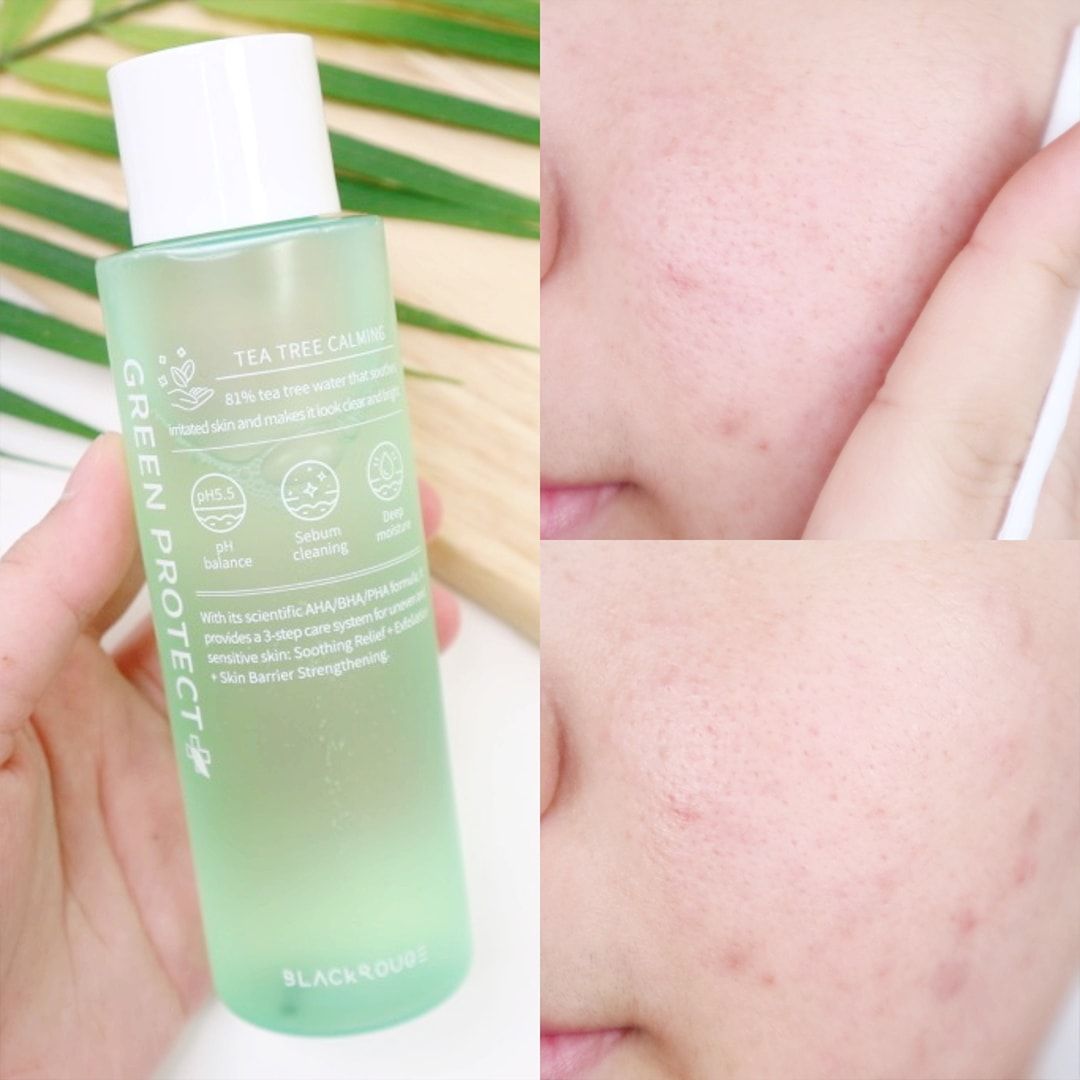 Nước cân bằng Black Rouge Green Protect Toner 150ml