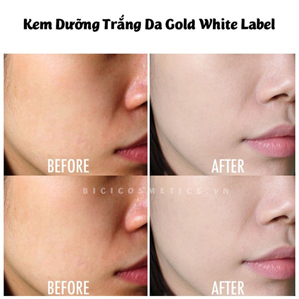 Kem Dưỡng Trắng Da Gold White Label