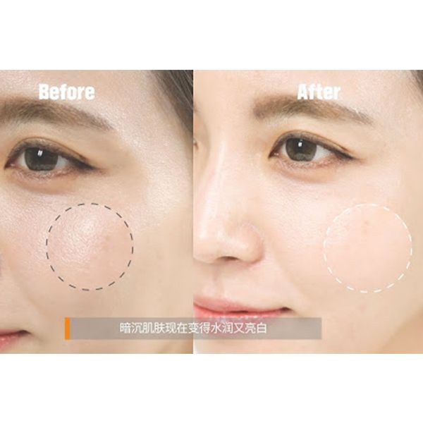 Kem Dưỡng Làm Mờ Đốm Nâu Dr.Jart+ V7 Vitalaser 2.1