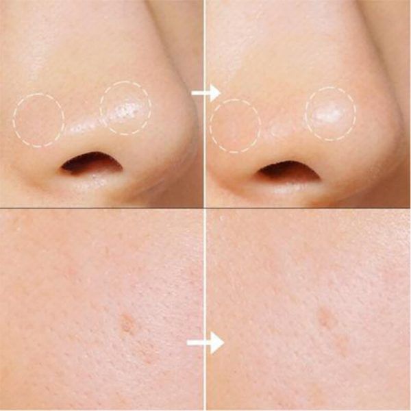 Mặt Nạ Tro Núi Lửa Trị Mụn Đầu Đen Innisfree Super Volcanic Pore Clay Mask 2X