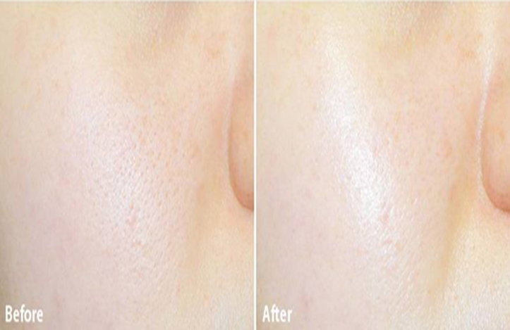 Kem Dưỡng Da Chống Lão Hóa Secret Key Starting Treatment Cream