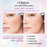  Serum Sáng Da Tức Thì L'Oreal Paris Glycolic - Bright Instant Glowing Serum 1.0% Glycolic Acid 30ML 