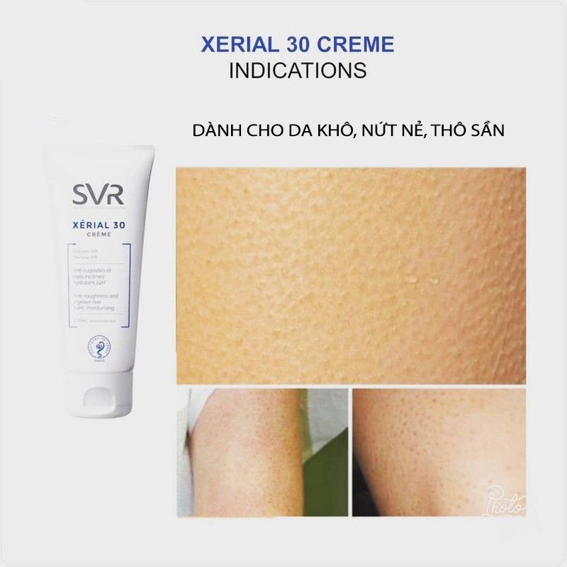  Kem Dưỡng Ẩm Cho Da Thô Sần Vùng Tay Chân SVR XERIAL 30 CREME 100ML (02/2024) 