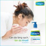  Sữa Rửa Mặt Dịu Nhẹ Cho Da Nhạy Cảm, Da Thường CETAPHIL Gentle Skin Cleanser Dry To Normal, Sensitive Skin 