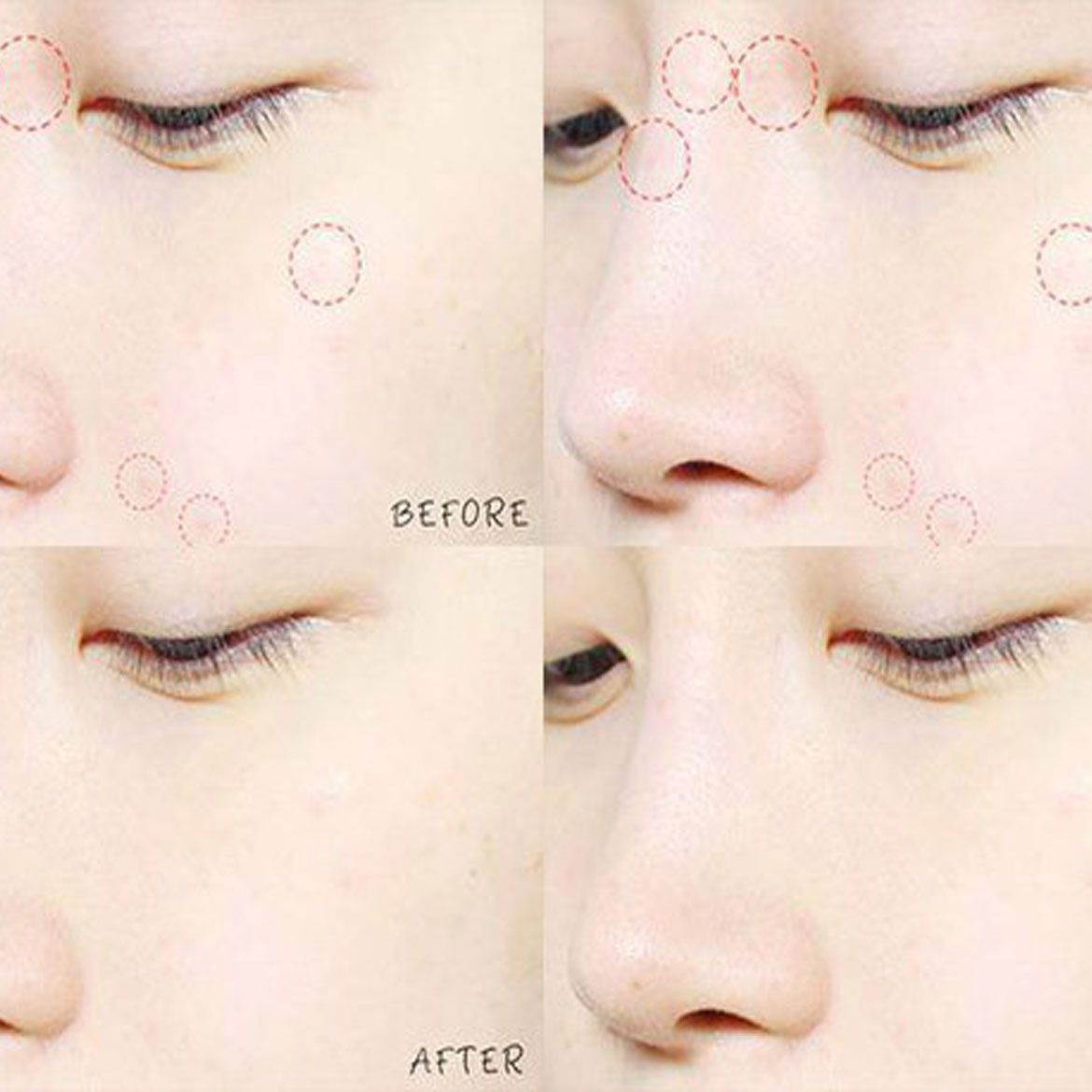 Miếng dán mụn The Saem See & Saw AC Control clear spot patch (24 miếng dán)