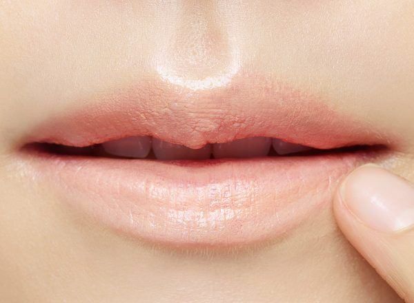 Kem Che Khuyết Điểm Môi Innisfree Tapping Lip Concealer