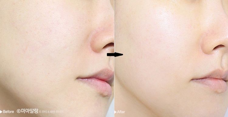 Nước Hoa Hồng Diếp Cá Mamonde Pore Clean Toner- 250 ml