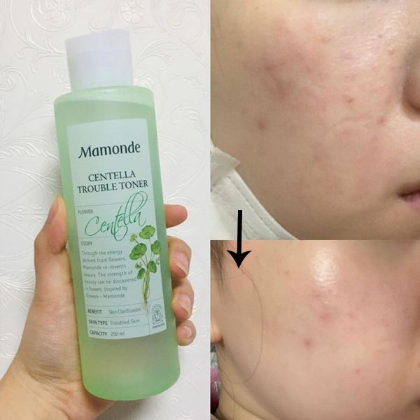 Nước Hoa Hồng Rau Má Mamonde Centella Trouble Toner 250ml