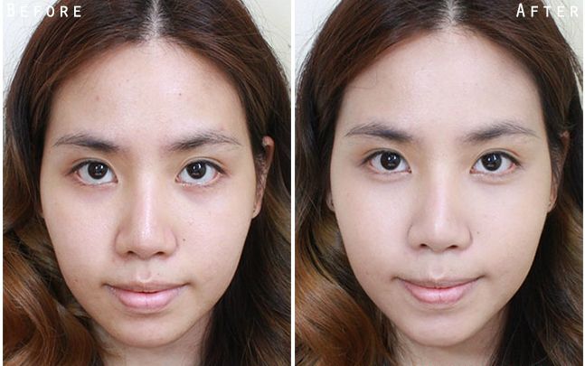  Kem Chống Lão Hóa & Trẻ Hóa Da OBAGI MEDICAL 360 Retinol 0.5 Cream 28g 