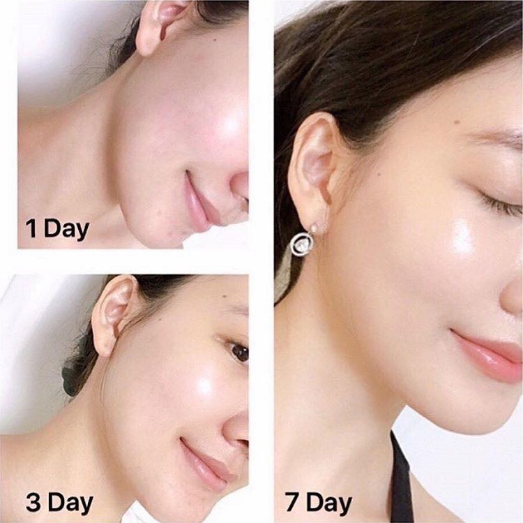  Kem Dưỡng Trắng Ngày/Đêm Mờ Thâm Nám OLAY TOTAL EFFECTS Nourish Vitamin C & B3 - 50ml 