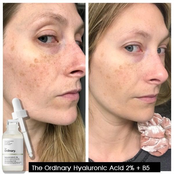 Serum Cấp Nước Và Phục Hồi Da The Ordinary Hyaluronic Acid 2% + B5