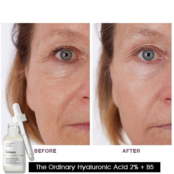  Serum Cấp Nước Và Phục Hồi Da THE ORDINARY Hyaluronic Acid 2% + B5 