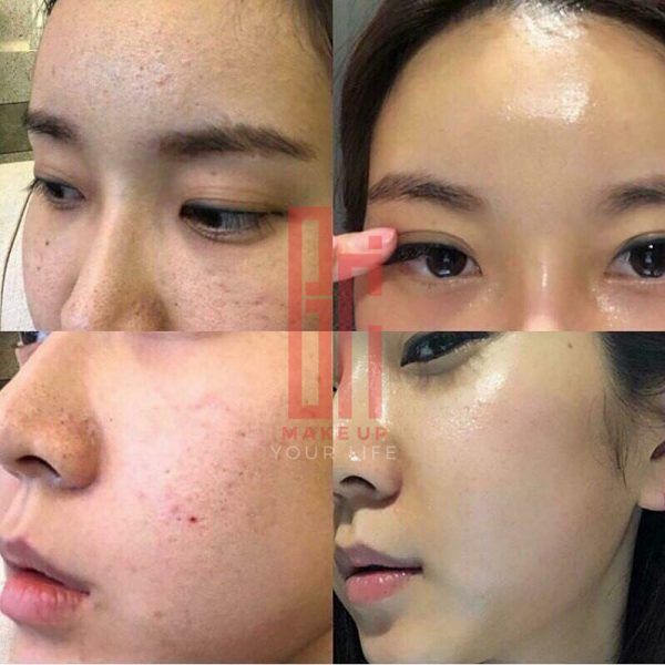 Serum Red Peel Tingle Serum -So’Natural