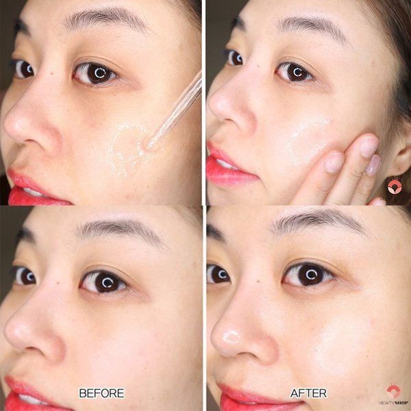 Tinh Chất Phục Hồi Da La Roche-Posay 30ml Hyalu B5 Serum 30ml (không tích điểm)