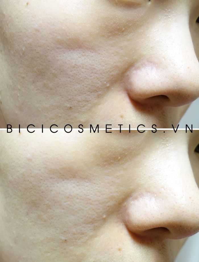 Nước hoa hồng The Saem See & Saw A.C Control Toner