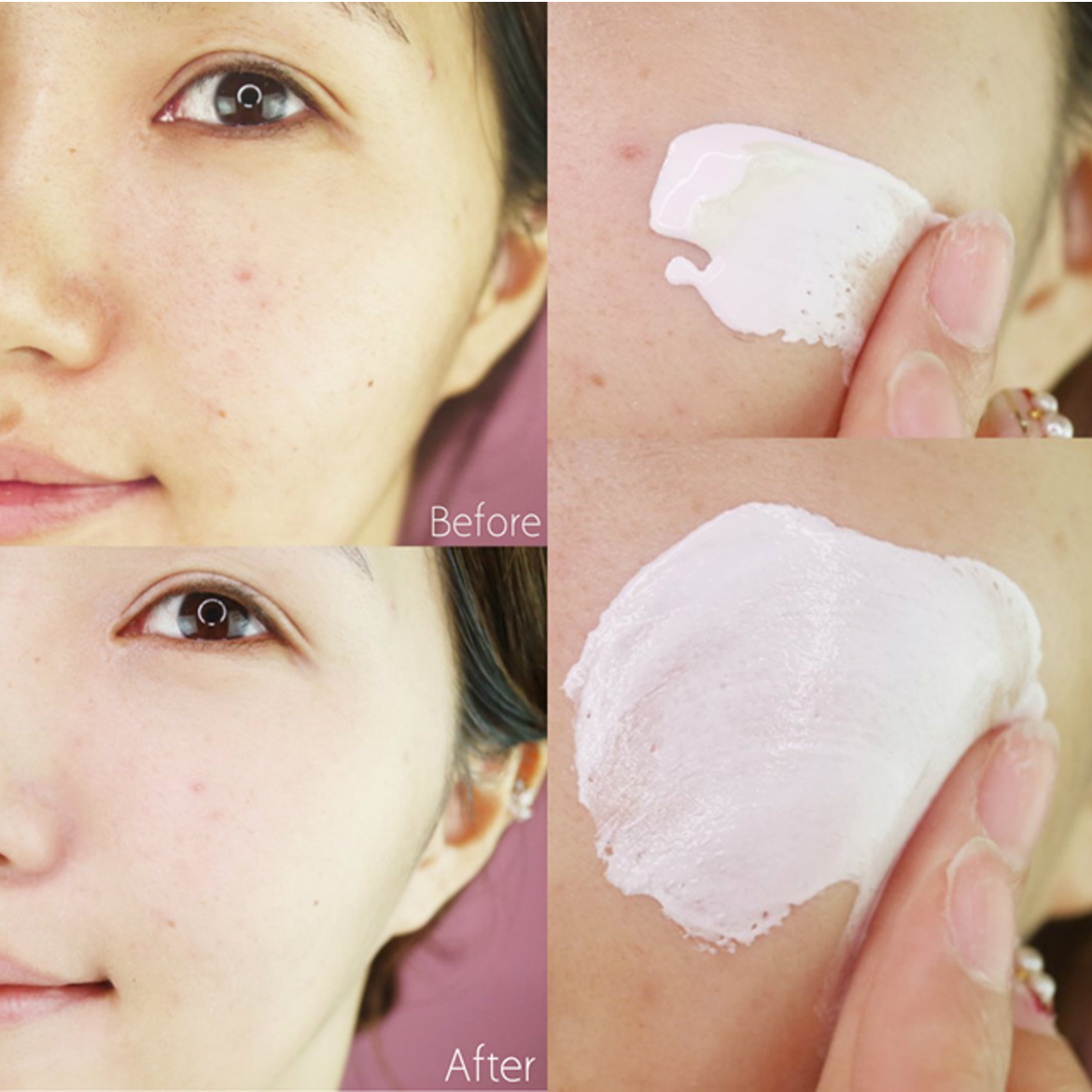 Kem dưỡng trắng Shiseido Senka White Beauty Cream