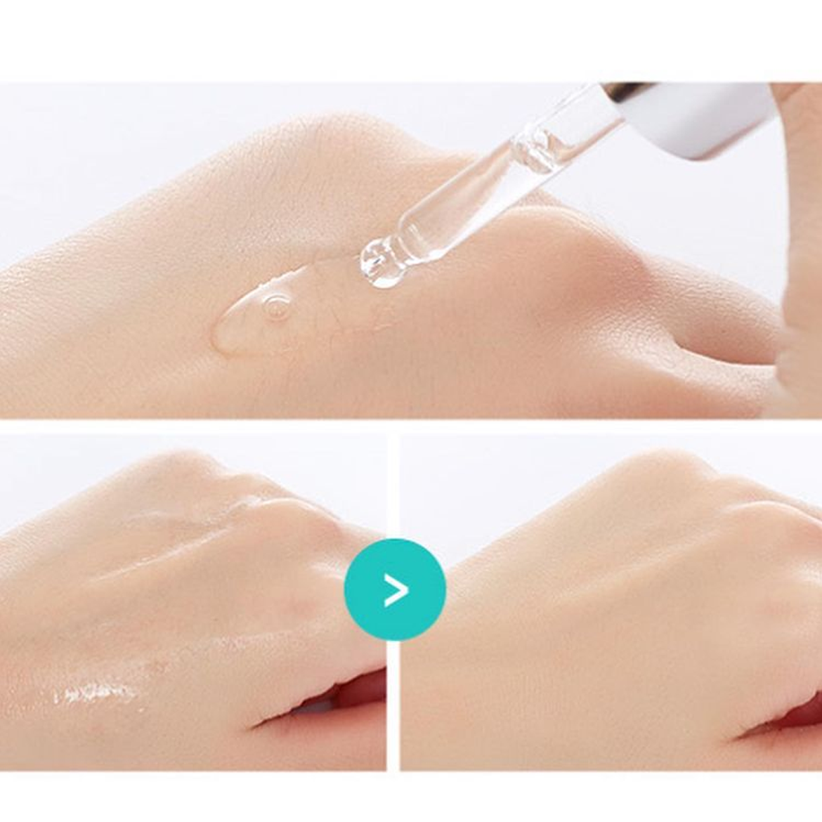 Tinh Chất Dưỡng Da Trị Mụn A'pieu Madecassoside Ampoule 30ml