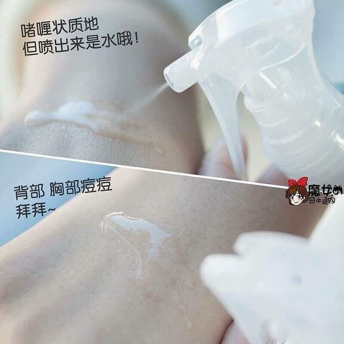 Xịt trị mụn lưng For Back Pelican Medicated Mist 100ml