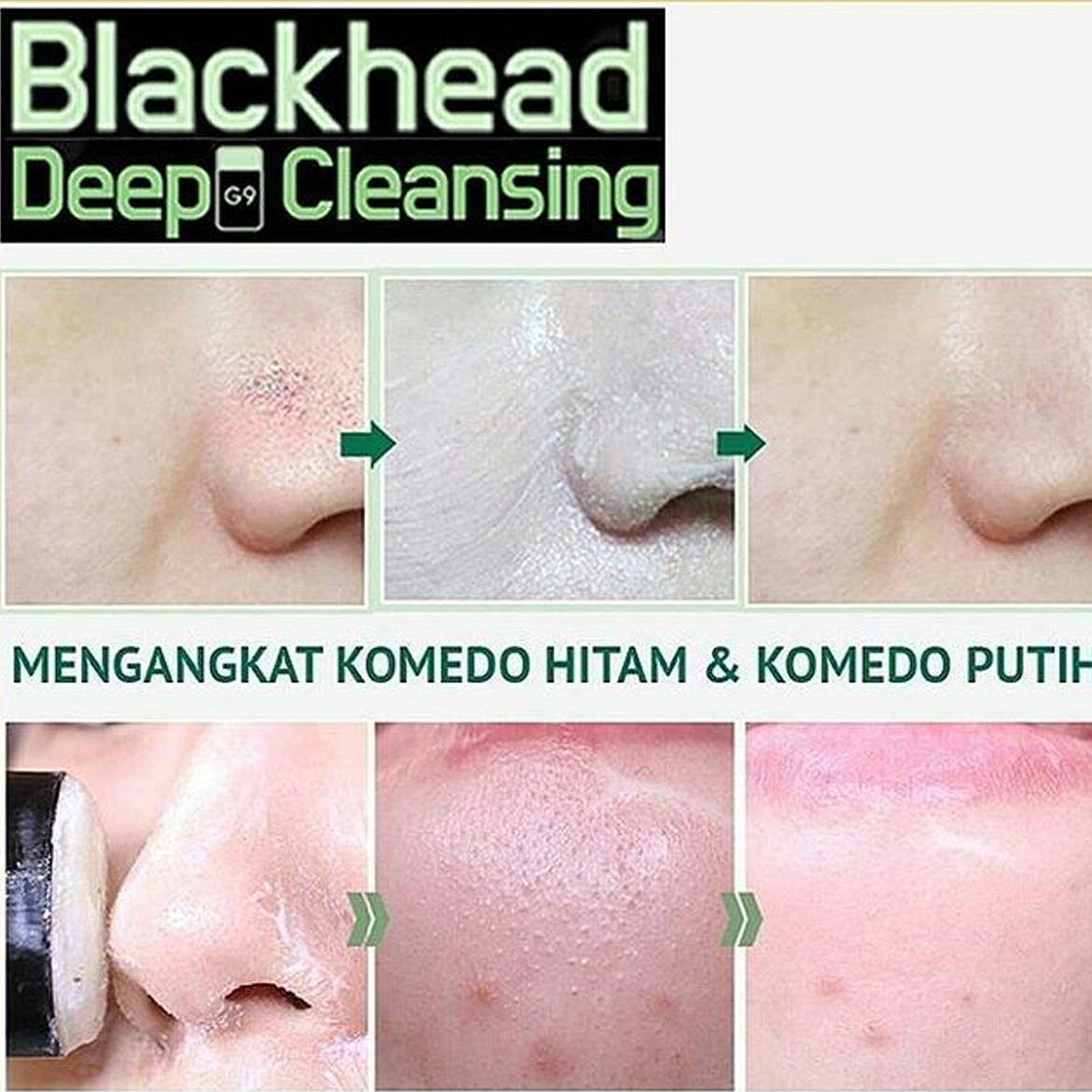 Sáp trị mụn đầu đen G9skin It Clean Blackhead Cleansing Stick