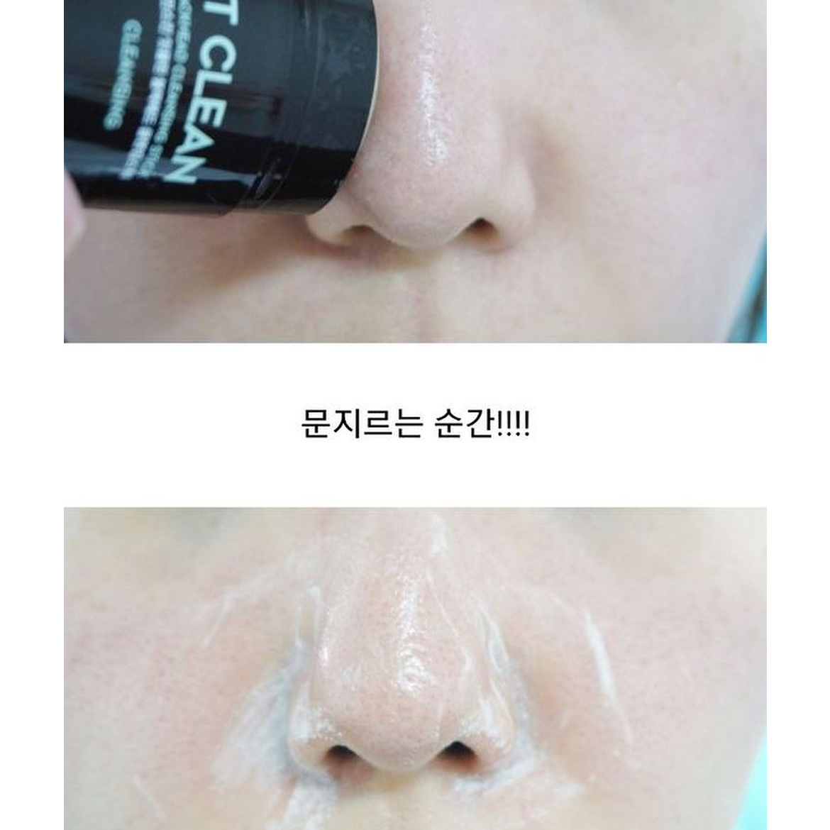 Sáp trị mụn đầu đen G9skin It Clean Blackhead Cleansing Stick