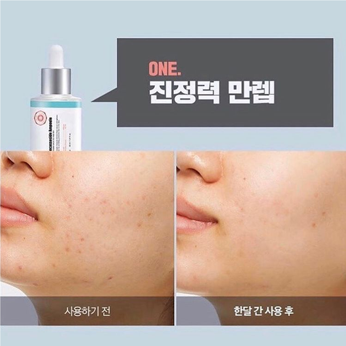 Tinh Chất Dưỡng Da Trị Mụn A'pieu Madecassoside Ampoule 30ml