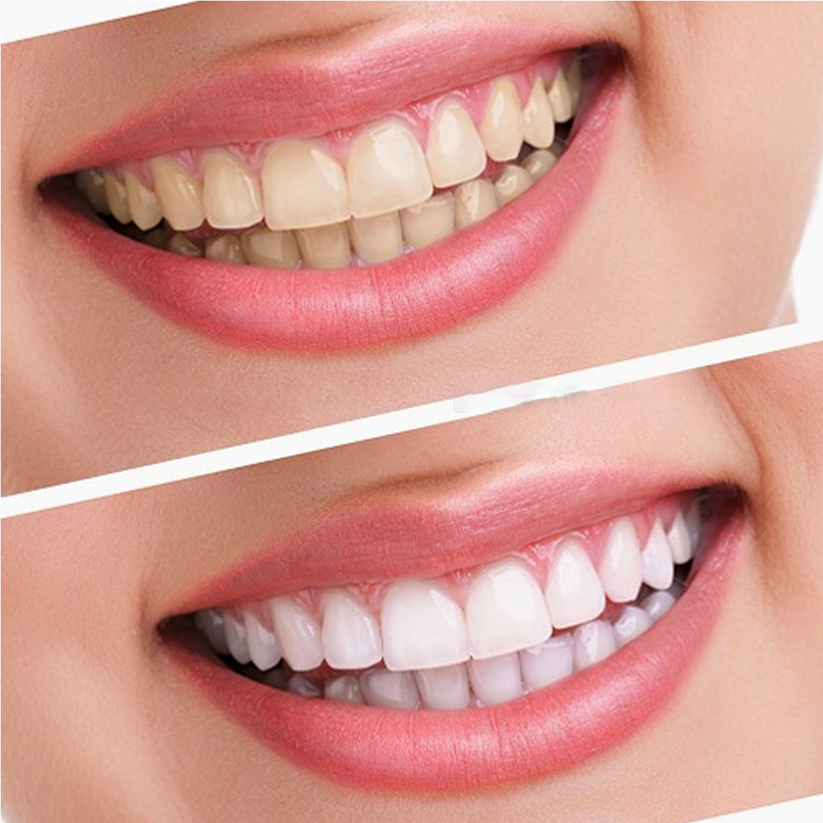 Kem Đánh Răng Crest 3D White Advanced Triple Whitening