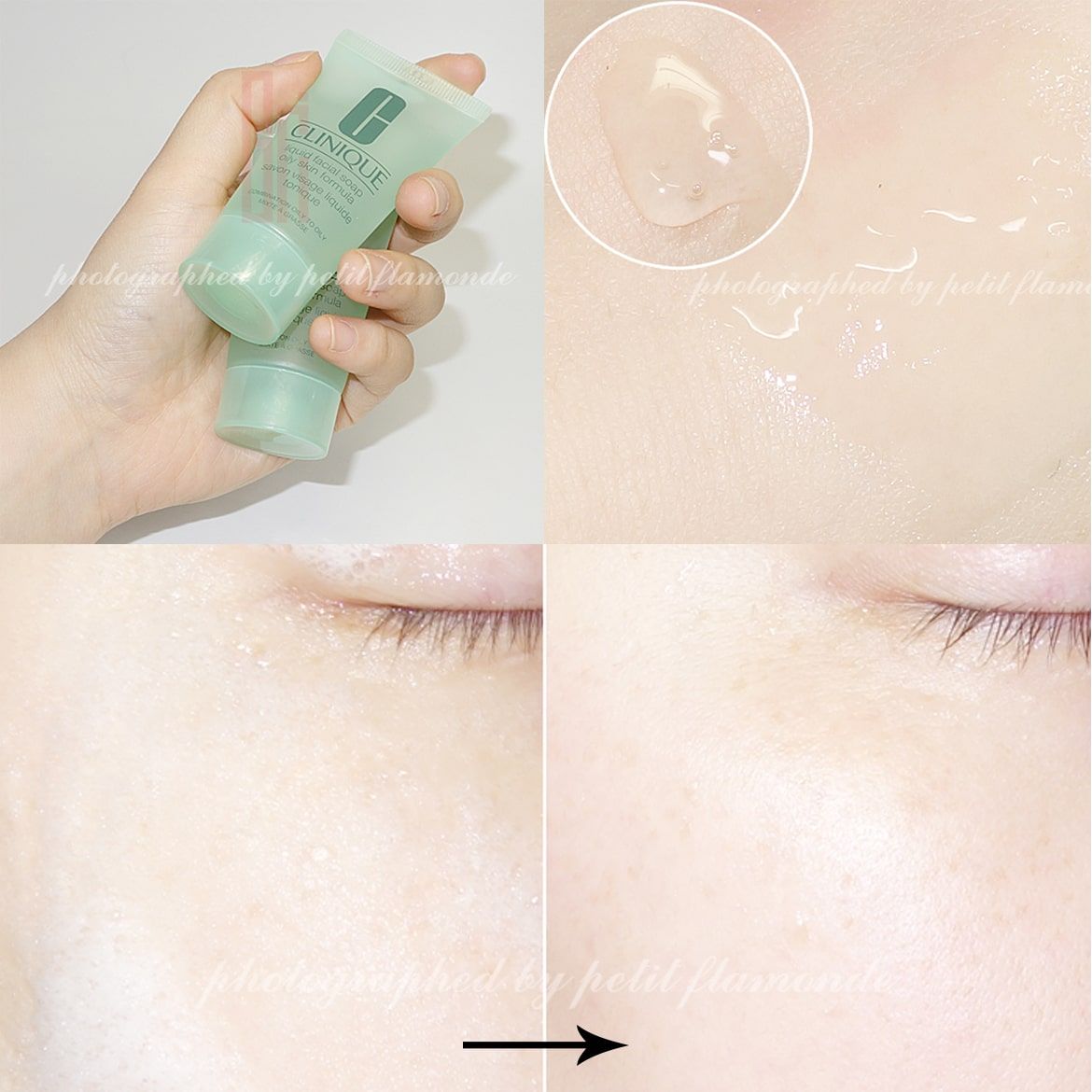 Set Dưỡng Da, Trang Điểm 3 Bước Clinique 3-Step Trial (5 sản phẩm)