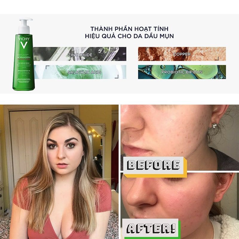 Sửa Rửa Mặt Dạng Gel Vichy Normaderm Phytosolution Intense Purifying Gel